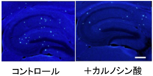 図2：海馬でのベータアミロイドの沈着