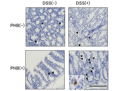 PHB供与による大腸の粘膜上皮の制御性T細胞の活性化