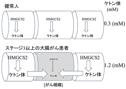 大腸管腔内のケトン体濃度の調節機構