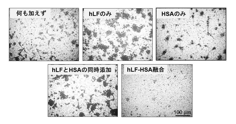 ヒトラクトフェリンとヒト⾎清アルブミンの融合タンパク質が、 がん細胞転移に関係する遊⾛を強⼒に阻害することを発⾒