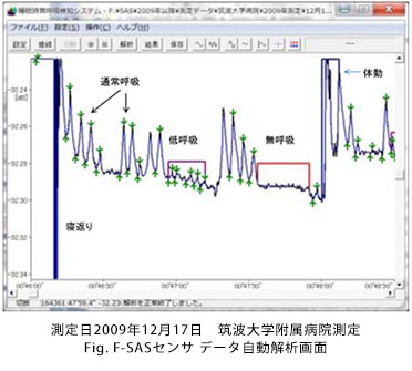 測定日2009年12月17日　筑波大学附属病院測定　Fig. F-SASセンサ データ自動解析画面